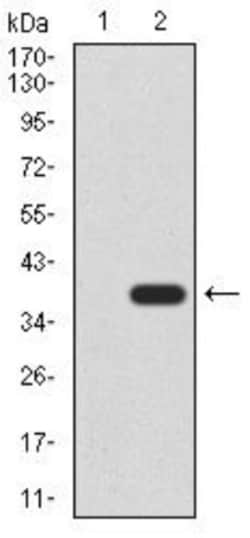 Cytokeratin 5 Antibody (3D6D4) - BSA Free, Novus Biologicals:Antibodies:Primary